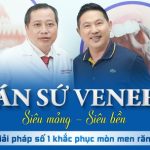 Ưu nhược điểm khi thực hiện dán sứ Veneer 413796805_324190040499263_4118138060846350404_n