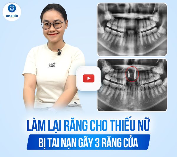 THUMBNAIL-YOUTUBE-2 (1)
